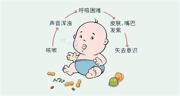 寶寶被噎住怎么辦？家長應掌握“海姆立克急救法”